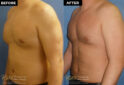 male body contouring before and after