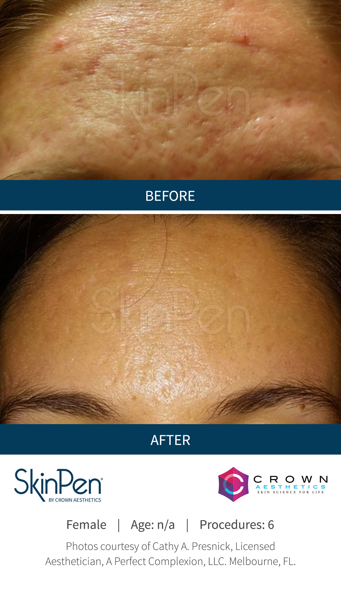 Skin Care Treatments Contemporary Plastic Surgery