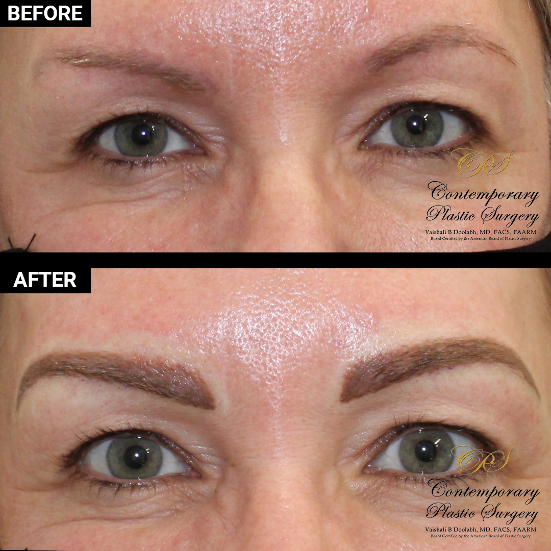 permanent makeup patient results at Contemporary Plastic Surgery