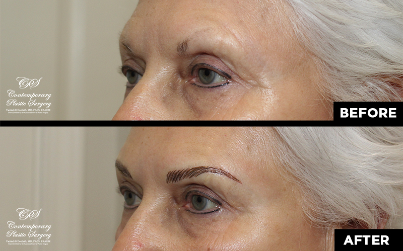 eyebrow microblading before and after