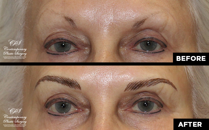 eyebrow microblading before and after