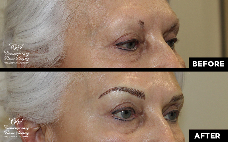 eyebrow microblading before and after