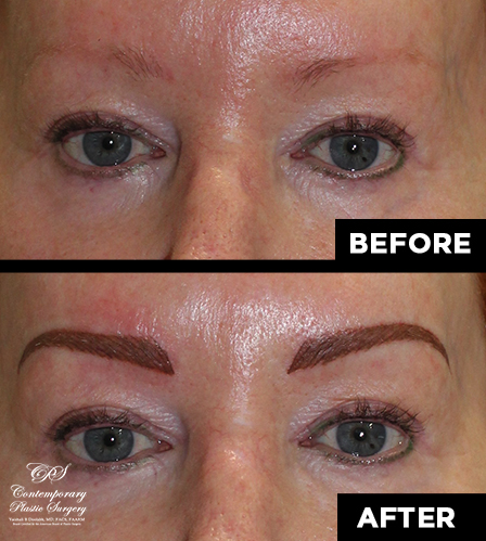 permanent makeup patient results at Contemporary Plastic Surgery