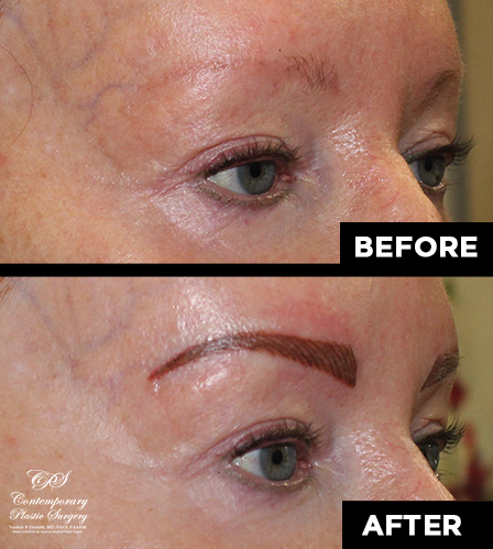 permanent makeup patient results at Contemporary Plastic Surgery