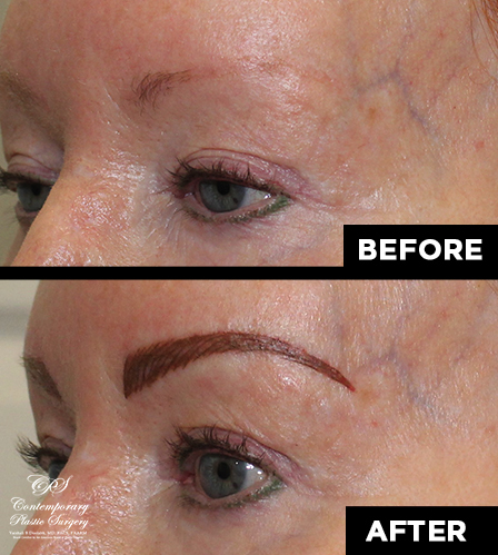 permanent makeup patient results at Contemporary Plastic Surgery