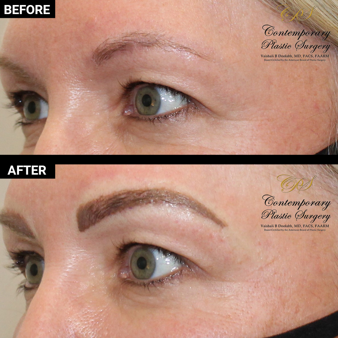 permanent makeup patient results at Contemporary Plastic Surgery