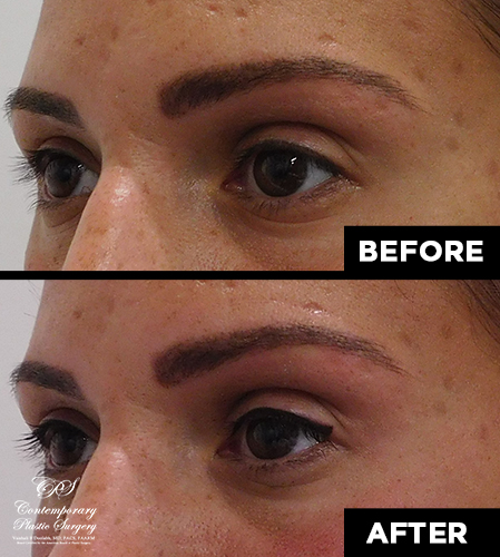 permanent makeup patient results at Contemporary Plastic Surgery